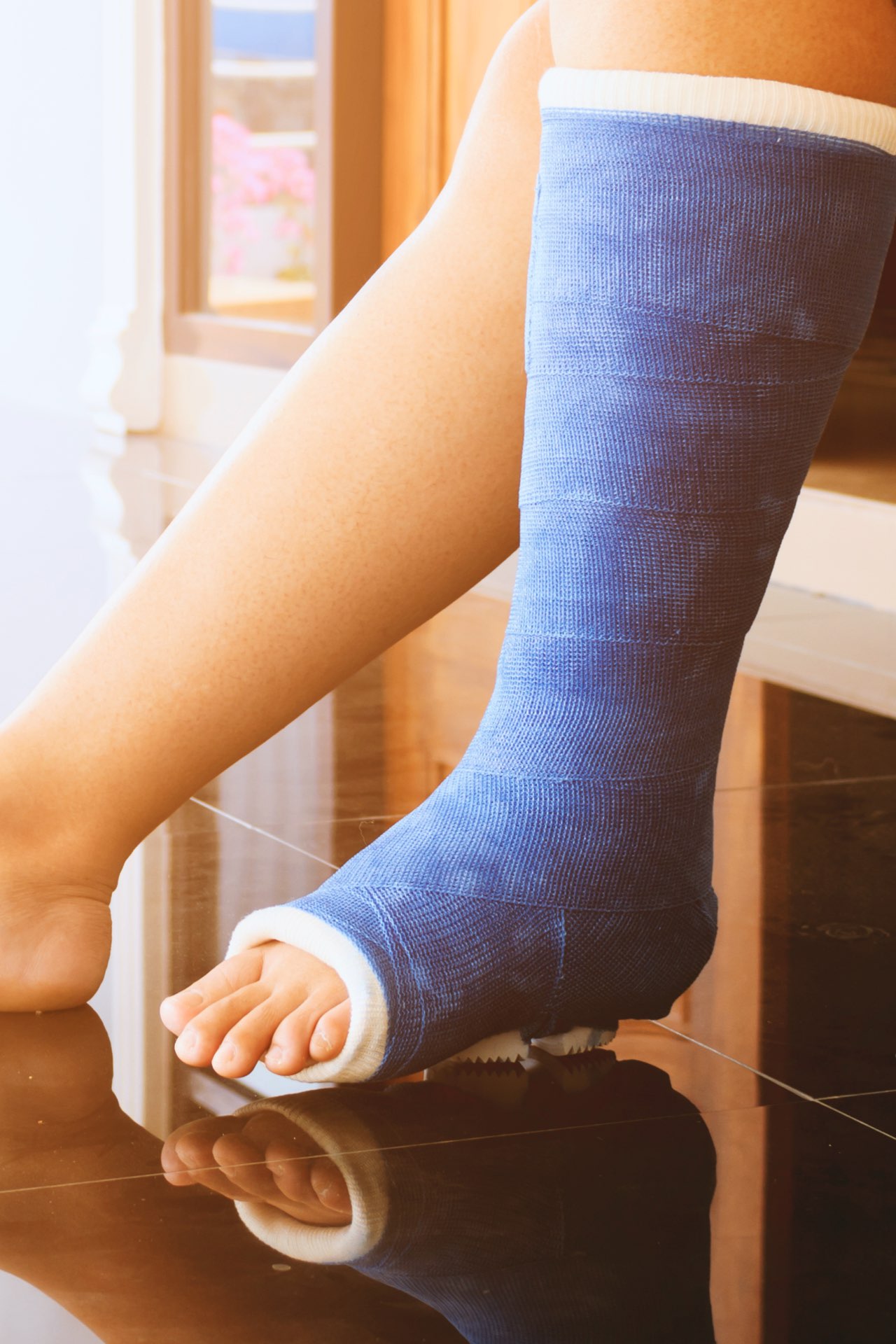 ankle-fracture-blue-cast