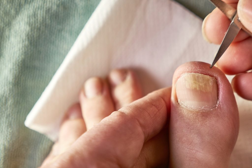 Blue, pale, or grey fingernails or lips | COVID infection | 11alive.com