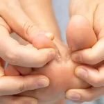 Hands pulling big toe and first toe apart to show foot fungus