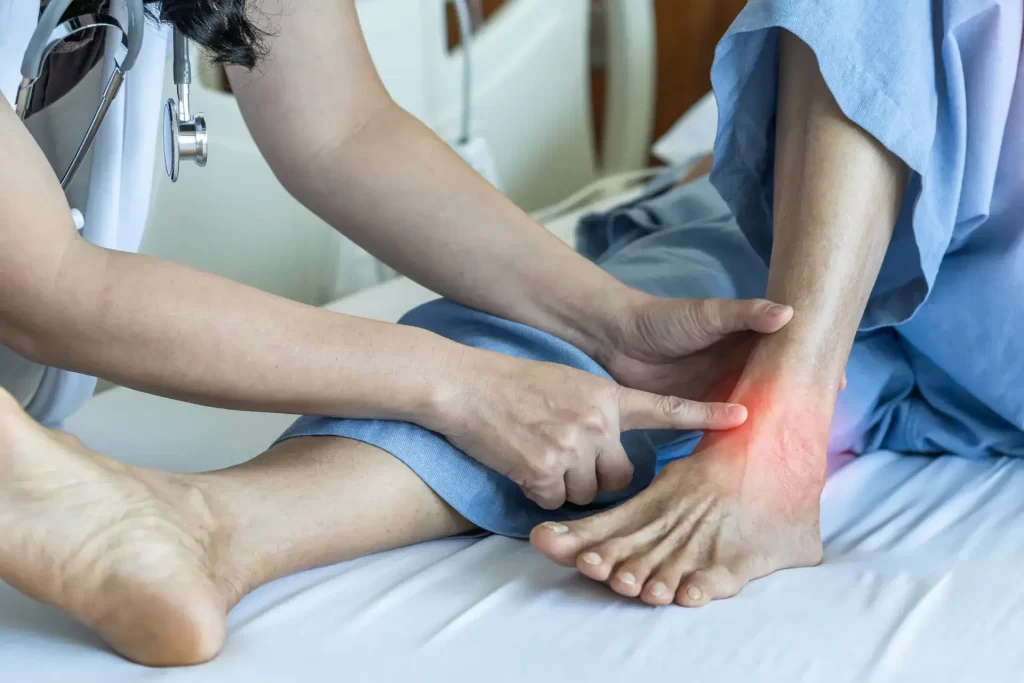 Doctor touching patient's ankle showing red from osteoarthritis pain
