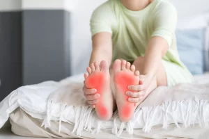 Woman sitting on bed with feet up; feet are red from rheumatoid arthritis pain
