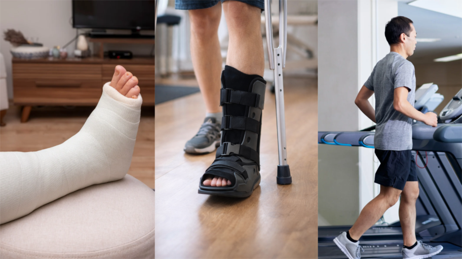 broken ankle process for recovery 