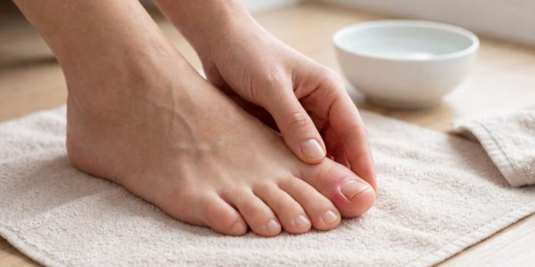 Close-up of a person inspecting a toe with an ingrown nail, illustrating will an ingrown toenail heal itself.