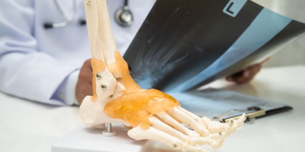 Doctor reviewing a foot skeleton model and X-ray to explain foot and ankle anatomy.