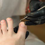 Healthy bare feet after treatment for fungal nail and skin conditions