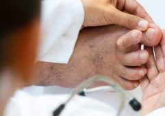 Close-up of a doctor examining a foot where the second toe crosses the big toe, illustrating issues with toes crossed