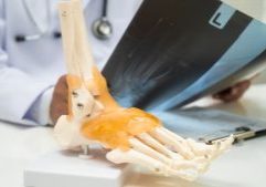 Doctor reviewing a foot skeleton model and X-ray to explain foot and ankle anatomy.