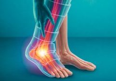 Illustration showing nerve pain in the foot after surgery, highlighting signs of nerve damage in foot after surgery