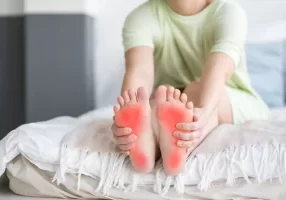 Woman sitting on bed with feet up; feet are red from rheumatoid arthritis pain